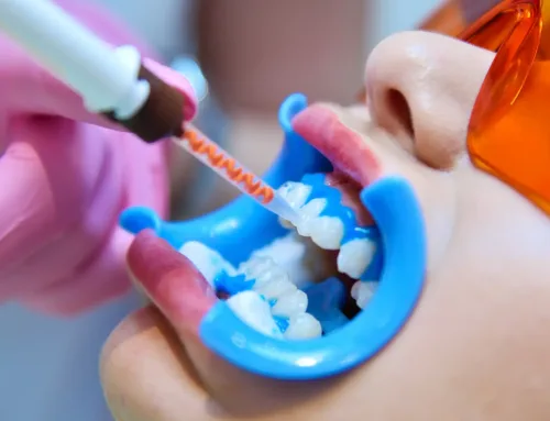 Les lasers dentaires : usages et bénéfices pour des soins moins invasifs